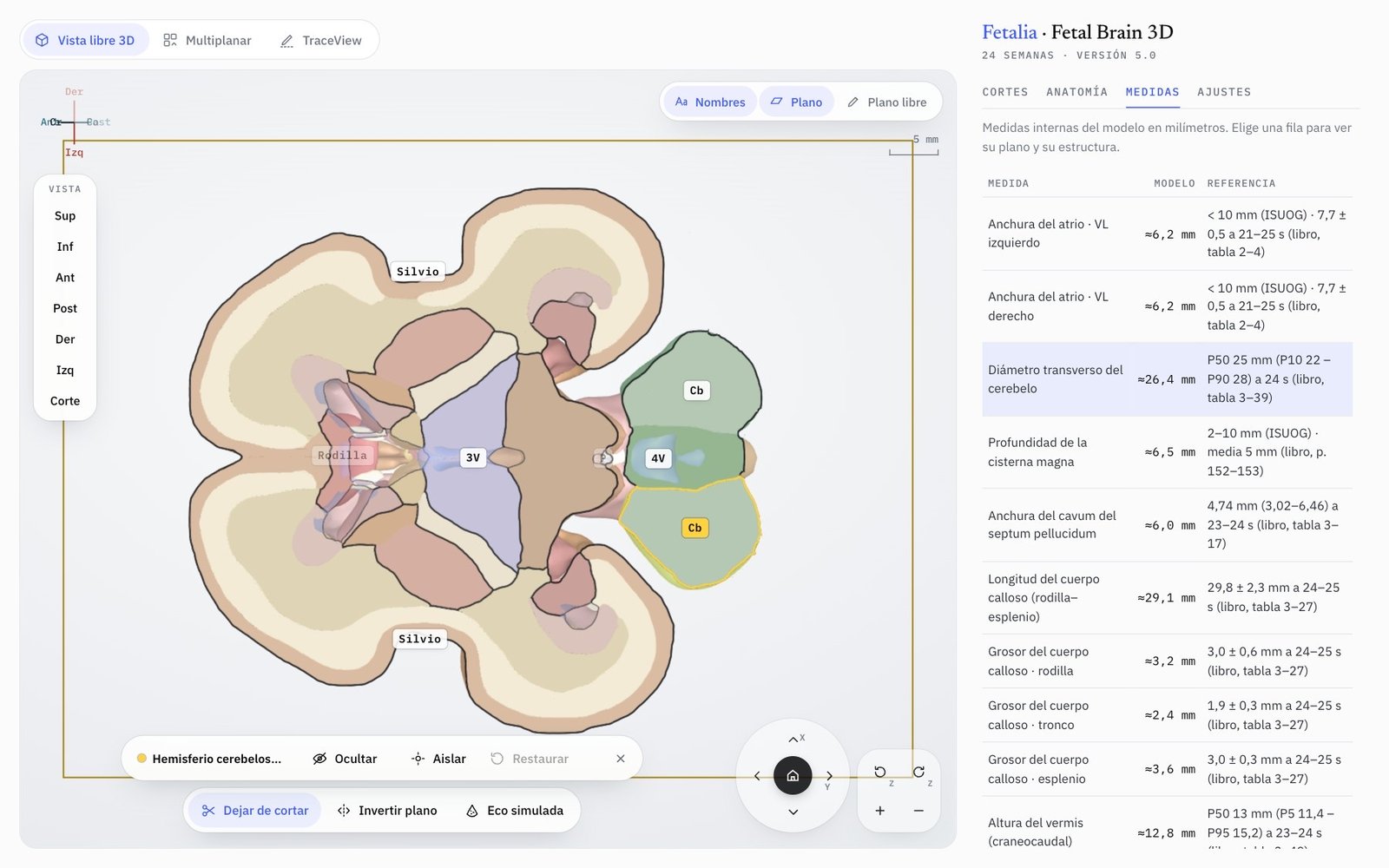 Fetal Brain 3D: corte transcerebeloso de frente con el cerebelo resaltado y la tabla de medidas internas del modelo
