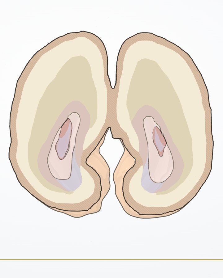 Corte coronal posterior («ojos de búho») del modelo