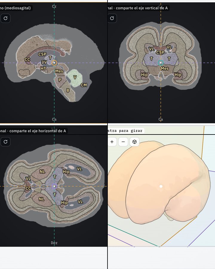 Multiplanar en eco simulada desde el sagital medio