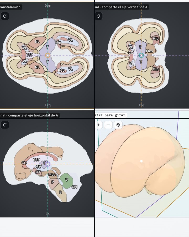 Multiplanar en anatomía: transtalámico, coronal, sagital y 3D