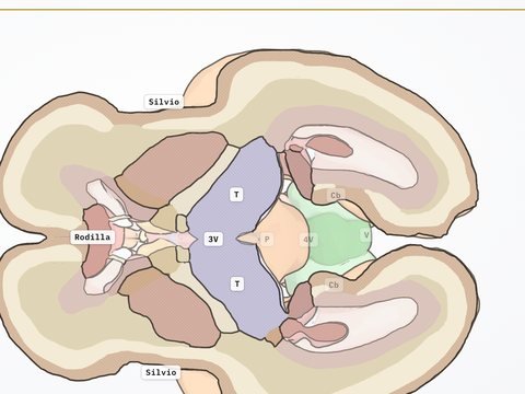 Corte axial transtalámico en anatomía