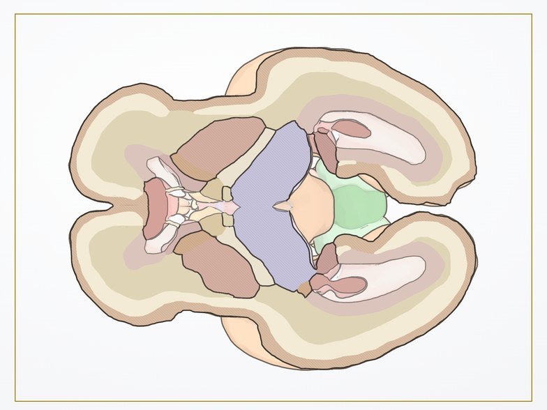 Axial transtalámico en el corte anatómico de Fetal Brain 3D