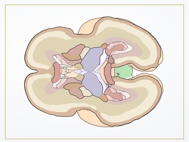 Axial transventricular · anatómico