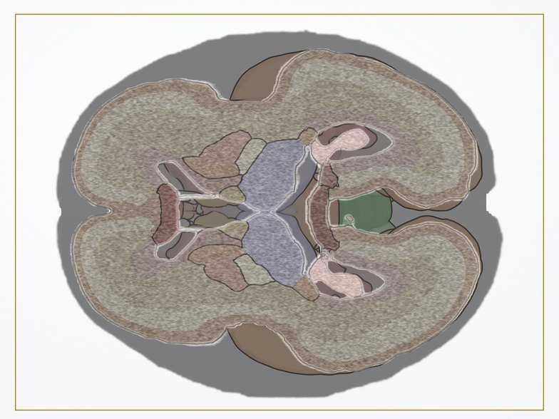 Corte en eco simulada de Fetal Brain 3D