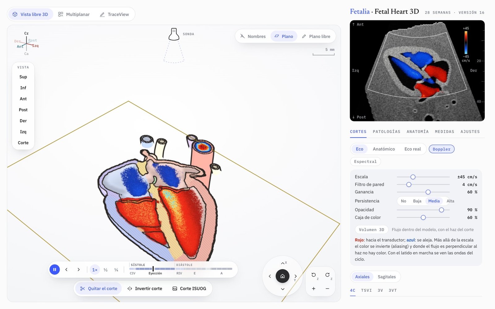 Doppler color en el corte de cuatro cámaras de Fetal Heart 3D, con el latido en marcha