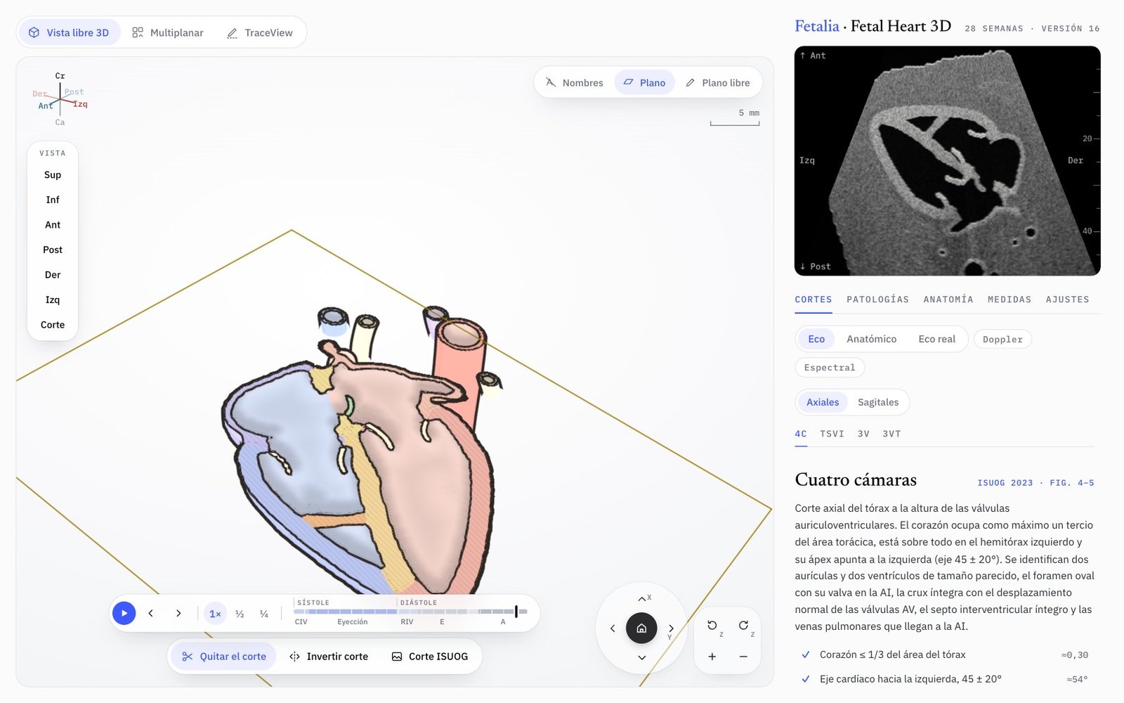 Fetal Heart 3D: el corazón fetal en Vista libre junto al corte de cuatro cámaras de la guía ISUOG