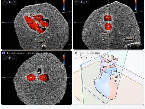 Multiplanar con Doppler color