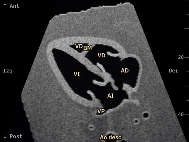 Cuatro cámaras en la imagen ecográfica simulada de Fetal Heart 3D