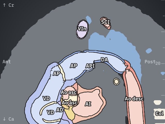 Arco ductal · esquema anatómico