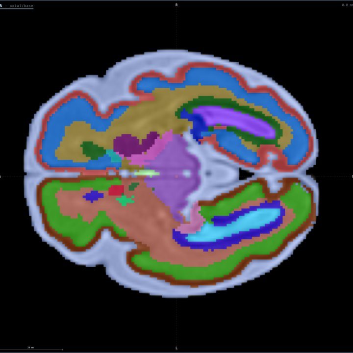 Capa Desarrollo · WMZ a las 30 semanas en Fetalia NeuroAtlas