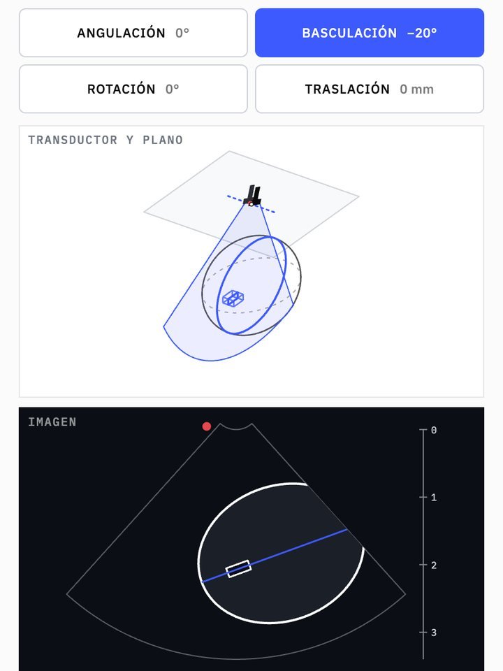 Laboratorio de movimientos · Basculación: el transductor y su plano, y la imagen