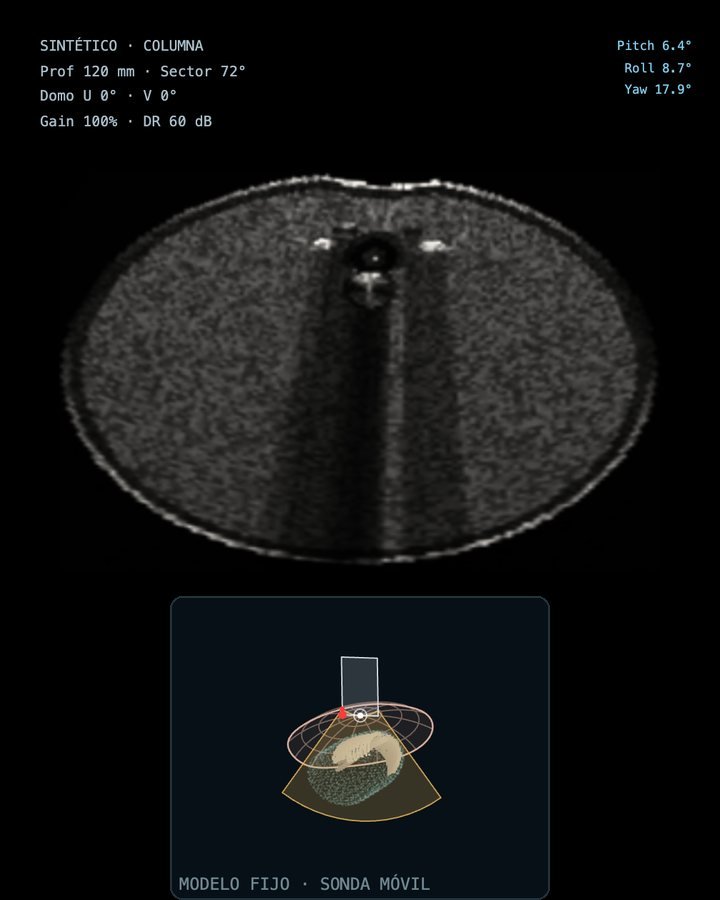 Imagen sintética en modo B · Columna