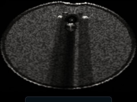 Columna sintética en modo B