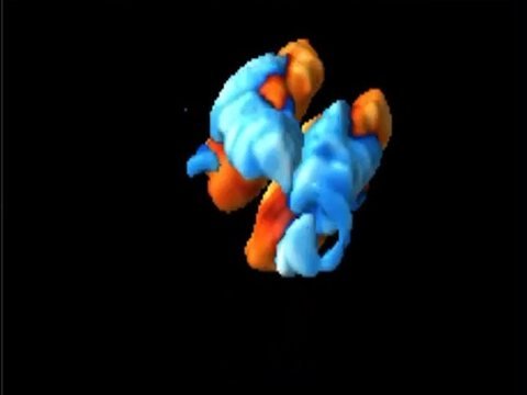 Render 3D del flujo Doppler